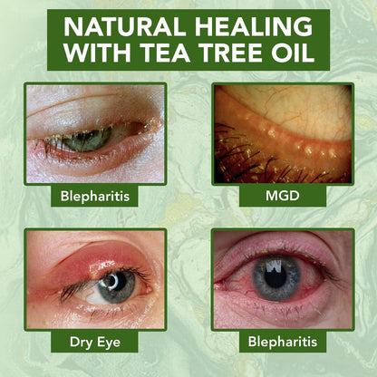 NOVEHA Teebaumöl Anti-Falten Augencreme - Augenlidcreme für trockene & juckende Haut, Narben | Feuchtigkeitscreme Gesichtscreme Behandlung - 50 ml