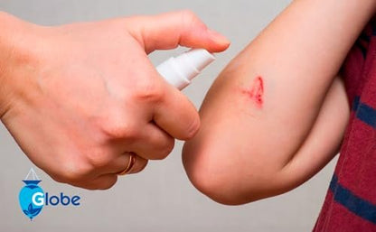 Globe Erste Hilfe Antiseptisches Spray, Wundreiniger, Benzalkoniumchlorid für kleine Schnitte, Schürfwunden und Verbrennungen, 60 ml (1)