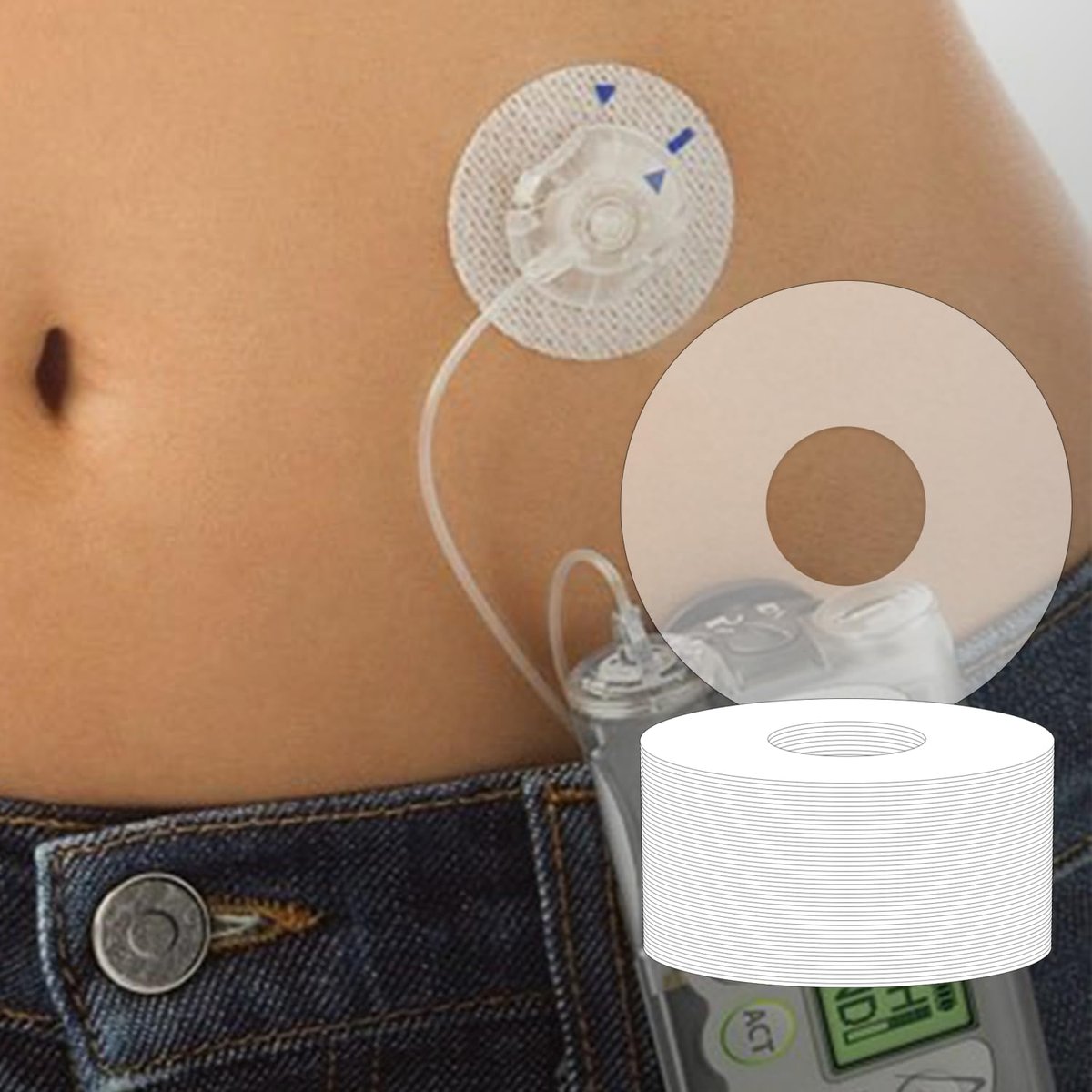 GTAGKOMMEN Universelle Klebepflaster für CGM und Insulinpumpen, 0,8-Zoll-Loch, 20 Stück, wasserdicht, 10-14 Tage haltbar, atmungsaktiv, durchsichtige Pflaster, vorgeschnittenes Klebeband, CGM-Schutz, hautfreundlich