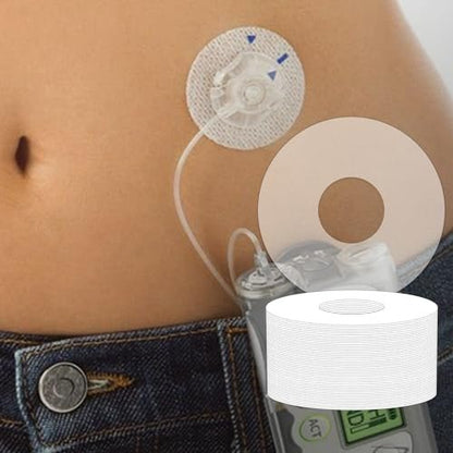 GTAGKOMMEN Universelle Klebepflaster für CGM und Insulinpumpen, 0,8-Zoll-Loch, 20 Stück, wasserdicht, 10-14 Tage haltbar, atmungsaktiv, durchsichtige Pflaster, vorgeschnittenes Klebeband, CGM-Schutz, hautfreundlich