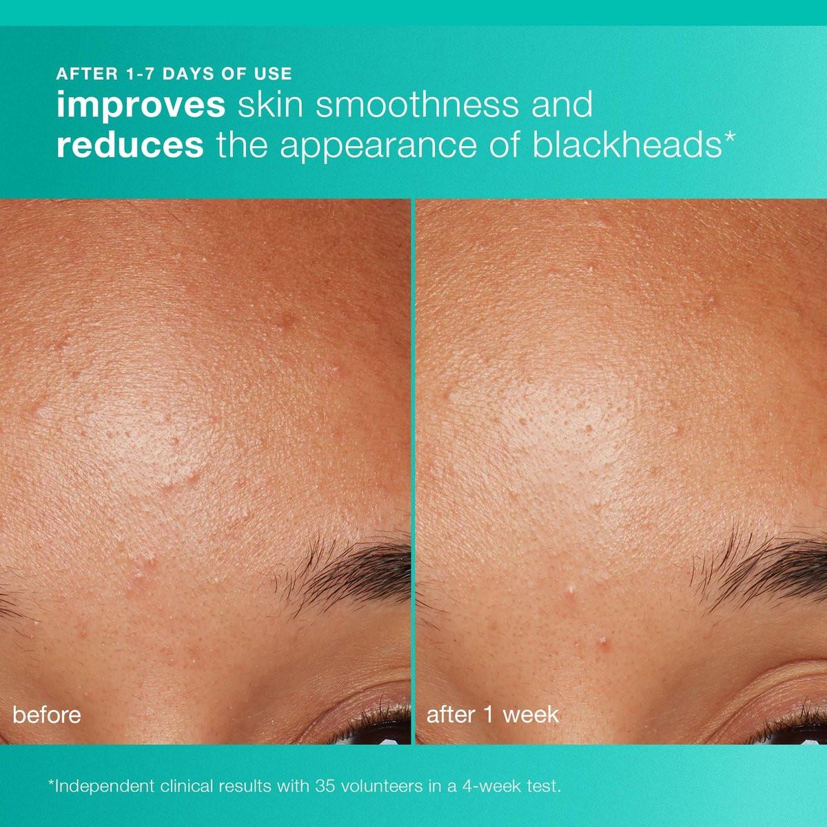 Dermalogica Clear and Brighten Kit – 3-teiliges Gesichtspflegeset mit Reiniger, Peeling und Serum