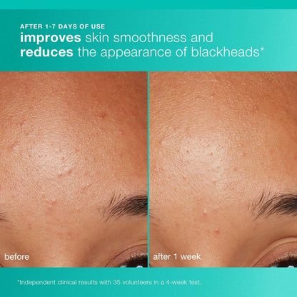 Dermalogica Clear and Brighten Kit – 3-teiliges Gesichtspflegeset mit Reiniger, Peeling und Serum