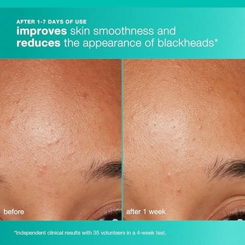 Dermalogica Clear and Brighten Kit – 3-teiliges Gesichtspflegeset mit Reiniger, Peeling und Serum