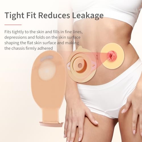 DERAYMI 10 Stück formbare Stoma-Barriereringe, 2 mm Dicke, hautfreundlich, für Ileostomie- und Kolostomiebeutel