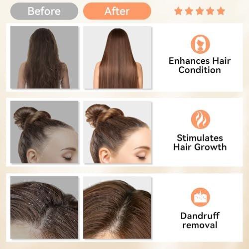 HEETA Kopfhautmassagegerät für Haarwachstum – Weiches Silikon-Scalp Scrubber Shampoo-Bürste zur Exfoliation, Schuppenentfernung & Stressabbau – Nass & Trocken für dickes, dünnes, lockiges Haar – Gradient Lila