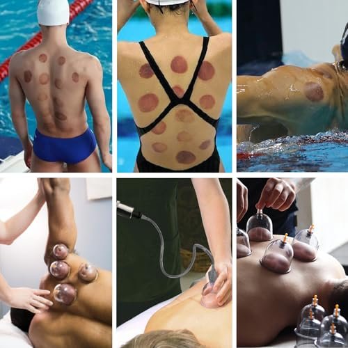 DEFUNX Schröpfen-Set, 19 Becher Schröpf-Set für Massagetherapie, Schröpftherapie-Set mit Pumpe für Rückenmassage, Schmerzlinderung, Physiotherapie
