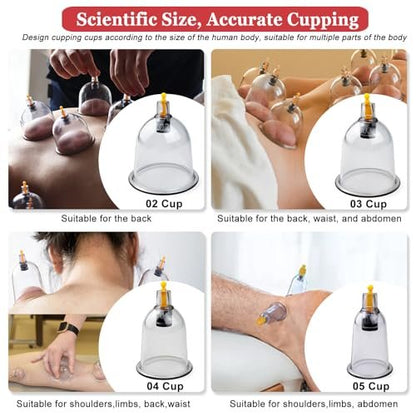 DEFUNX Schröpfen-Set, 19 Becher Schröpf-Set für Massagetherapie, Schröpftherapie-Set mit Pumpe für Rückenmassage, Schmerzlinderung, Physiotherapie