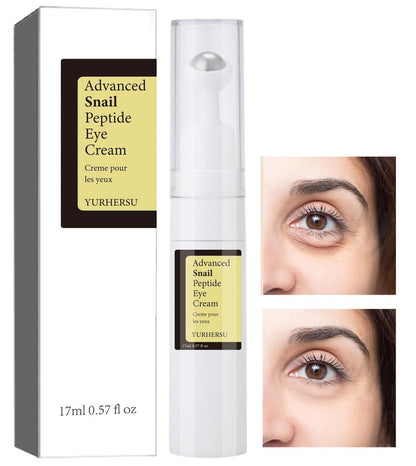 ELCHHIRSCH Snail Peptide Augencreme mit 73% Schneckenschleim & 2% Nicotinamid gegen dunkle Augenringe, Schwellungen & Falten, mit 360° Massageroller, 0,57 fl oz