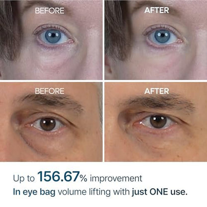 Dr.Melaxin Eyephalt Eyebag Cream 10ml – Augencreme gegen Tränensäcke & Schwellungen