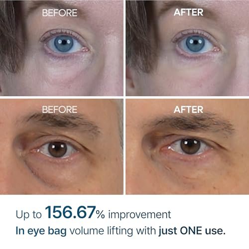 Dr.Melaxin Eyephalt Eyebag Cream 10ml – Augencreme gegen Tränensäcke & Schwellungen