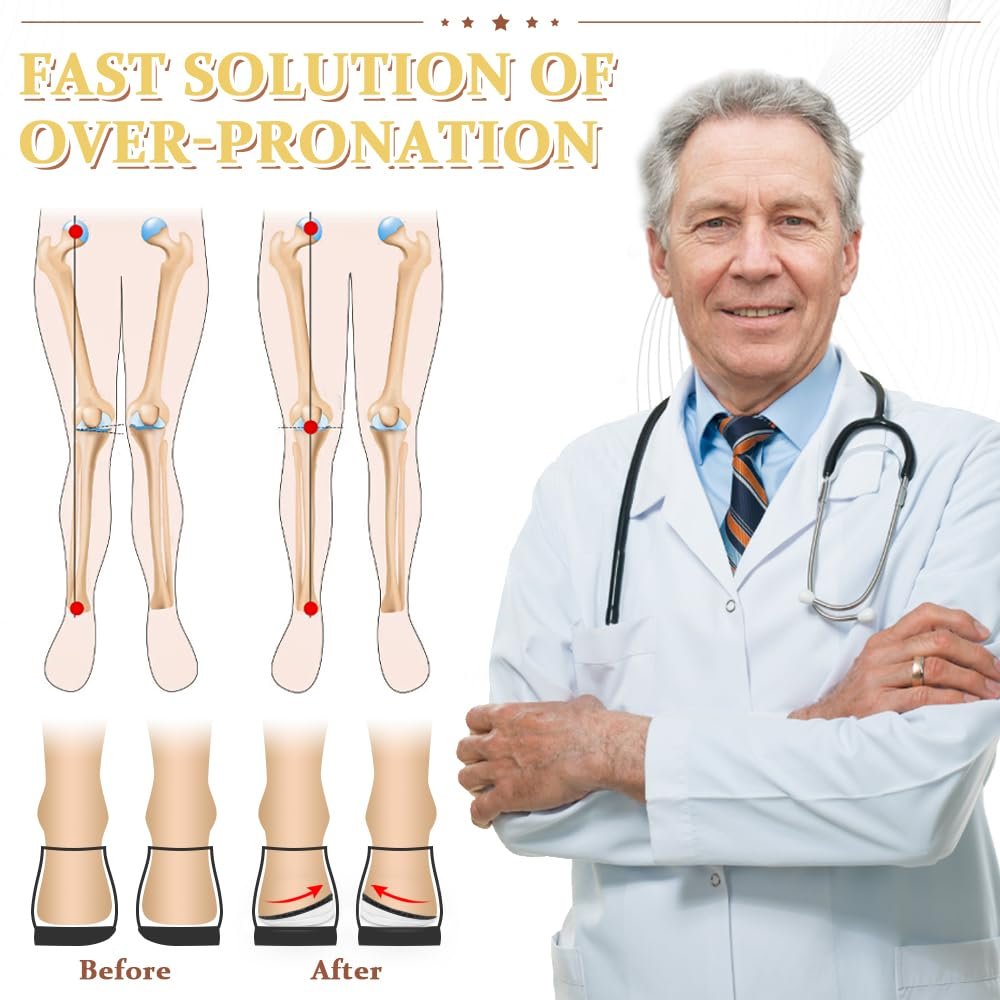 BIGGCOOL Korrektur-Einlegesohlen für Supination & Überpronation, Orthopädische Keilsohlen für Fußausrichtung, O-Beine, Knieschmerzen (Schwarz-3 Schichten, L: Damen 8-12/Herren 7.5-13)