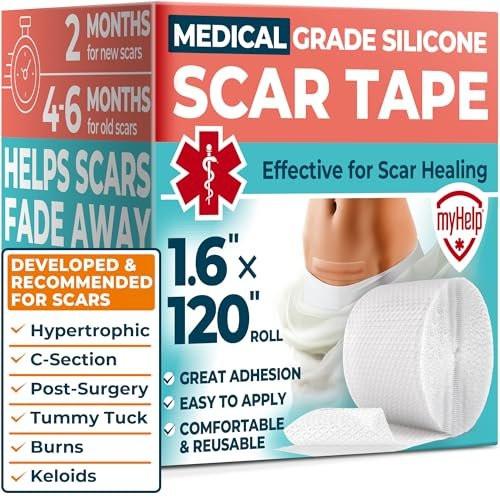 MYHELP Medizinisches Silikon-Narbenband - Transparent (1,6" x 120") - Sichtbare Verbesserung bei Operations- und Keloidnarben - Wiederverwendbare Silikon-Narbenfolien - Einfach zu verwendendes Silikonband für Narben