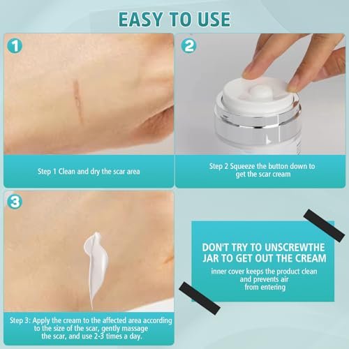 Pumkot Fortschrittliche Narbencreme, Silikongel für Narben, Professionelle Narbenentfernungscreme für Operationsnarben, Dehnungsstreifen, alte und neue Narben, 1,7 oz (50 ml)