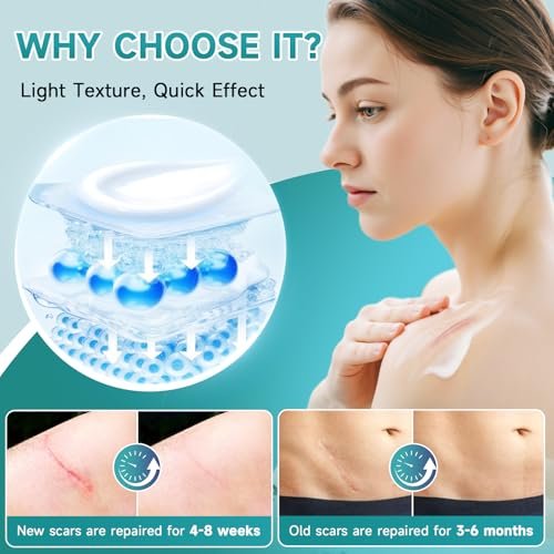 Pumkot Fortschrittliche Narbencreme, Silikongel für Narben, Professionelle Narbenentfernungscreme für Operationsnarben, Dehnungsstreifen, alte und neue Narben, 1,7 oz (50 ml)