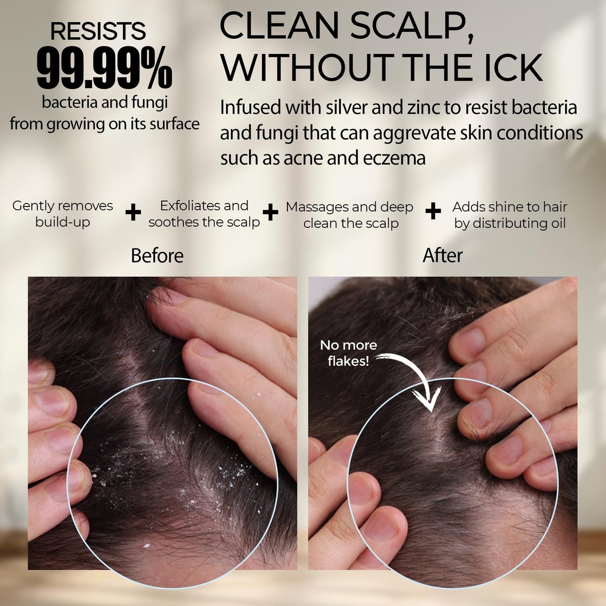 Fiora Naturals Scalp Massager Shampoo Brush – Silikon-Kopfhautpeeling-Bürste für Schuppenbefreiung & Haarwachstum, für nasses & trockenes Haar, für Männer, Frauen, Kinder – BPA-frei