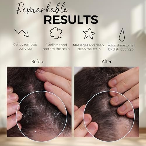 Fiora Naturals Kopfhaut-Massagebürste – Silikon-Shampoo-Bürste für Dandruff-Entfernung und Haarwachstum, für nasses & trockenes Haar, für Männer, Frauen, Kinder – BPA-frei (Marine)
