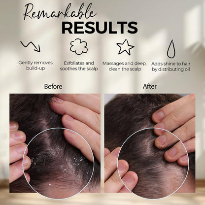 Fiora Naturals Kopfhautmassagegerät Shampoo-Bürste – Silikon-Kopfhautpeelingbürste für Schuppenentfernung und Haarwachstum, Bürste für nasses & trockenes Haar, für Männer, Frauen, Kinder – BPA-frei