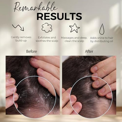 Fiora Naturals Kopfhautmassagegerät Shampoo-Bürste – Silikon-Kopfhautpeelingbürste für Schuppenentfernung und Haarwachstum, Bürste für nasses & trockenes Haar, für Männer, Frauen, Kinder – BPA-frei