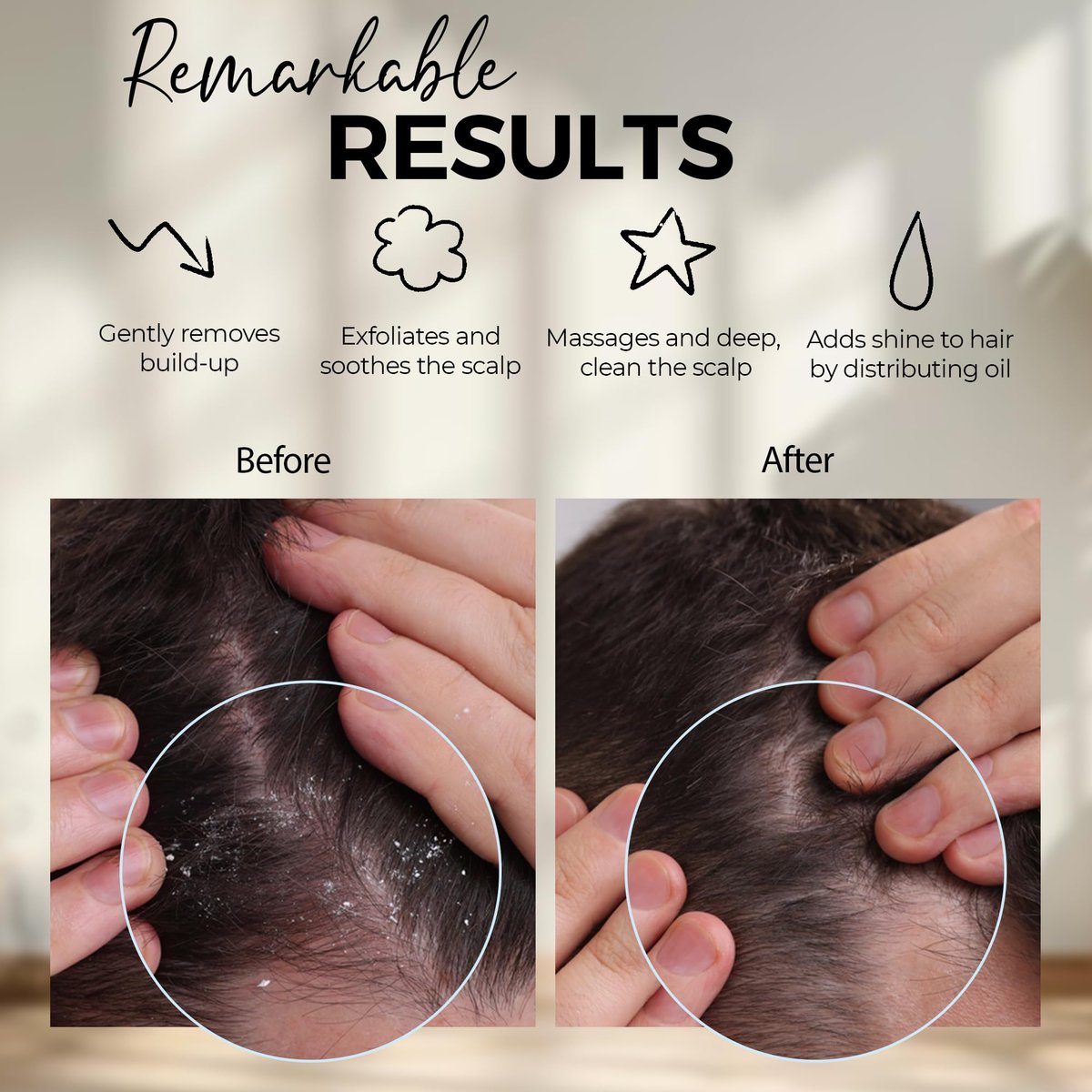Fiora Naturals Kopfhaut-Massagebürste – Silikon-Shampoo-Bürste für Dandruff-Entfernung und Haarwachstum, für nasses & trockenes Haar, für Männer, Frauen, Kinder – BPA-frei (Marine)