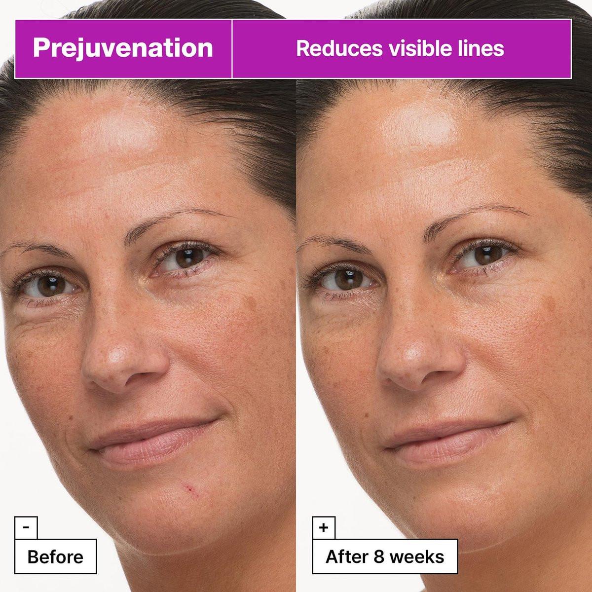 Dr.Jart+ Prejuvenation Firming Bakuchiol Creme mit Kollagenpeptiden – Koreanische Anti-Aging-Gesichtscreme für empfindliche Haut, 50 ml