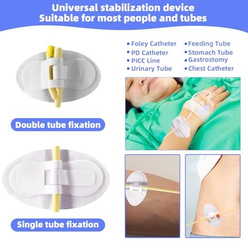 20 Stück Foley-Katheter-Befestigungsvorrichtung, Katheterschlauchhalter, Klebeband für Urinbeutel, Beinhalter für Katheterzubehör für Einzel-/Doppelschlauch, G-Sonde und Ernährungssonde