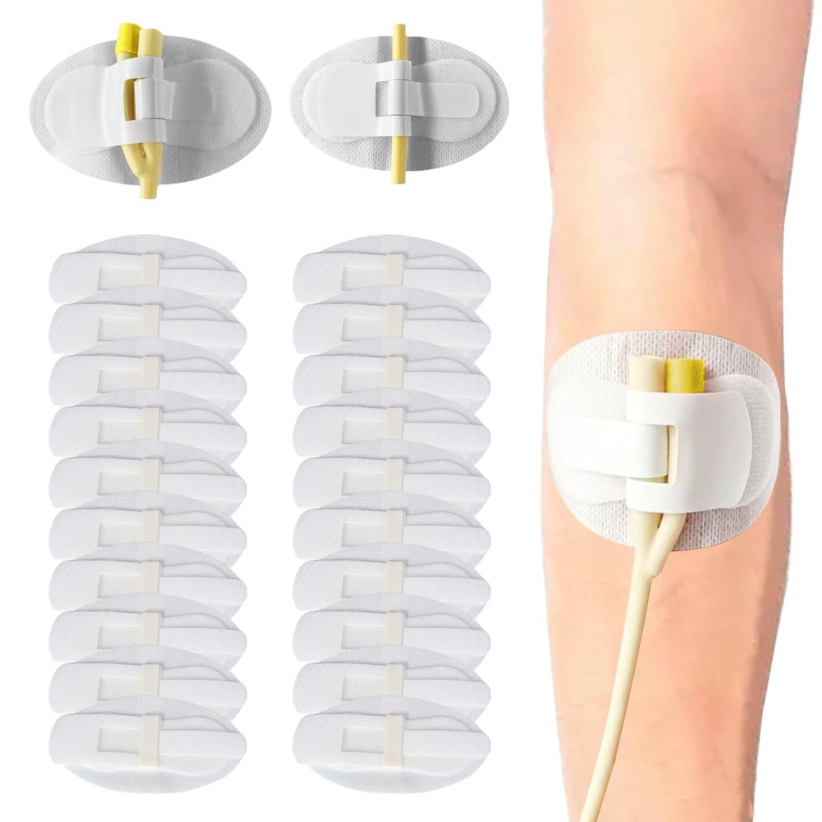 20 Stück Foley-Katheter-Befestigungsvorrichtung, Katheterschlauchhalter, Klebeband für Urinbeutel, Beinhalter für Katheterzubehör für Einzel-/Doppelschlauch, G-Sonde und Ernährungssonde
