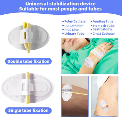 20 Stück Foley-Katheter-Befestigungsvorrichtung, Katheterschlauchhalter, Klebeband für Urinbeutel, Beinhalter für Katheterzubehör für Einzel-/Doppelschlauch, G-Sonde und Ernährungssonde