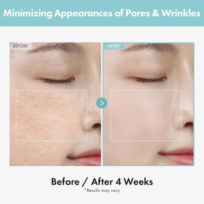 TOSOWOONG Porenverfeinernde Creme, Porenminimierer mit AHA - Glykolsäure und Milchsäure, Ölkontroll-Gesichtsfeuchtigkeitscreme für fettige Haut, Texturglättung für feine Linien, Koreanische Hautpflege, 50g / 1,76 oz.