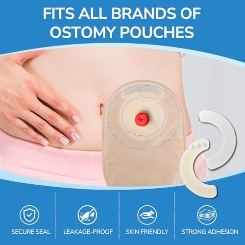 Heagimed 20 Stück Ostomy Barrier Strips – Hautfreundliche Hydrokolloid-Barrierestreifen für Stomabeutel, Kolostomie- und Ileostomie-Versorgung