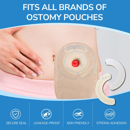 Heagimed 20 Stück Ostomy Barrier Strips – Hautfreundliche Hydrokolloid-Barrierestreifen für Stomabeutel, Kolostomie- und Ileostomie-Versorgung