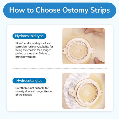 Heagimed 20 Stück Ostomy Barrier Strips – Hautfreundliche Hydrokolloid-Barrierestreifen für Stomabeutel, Kolostomie- und Ileostomie-Versorgung