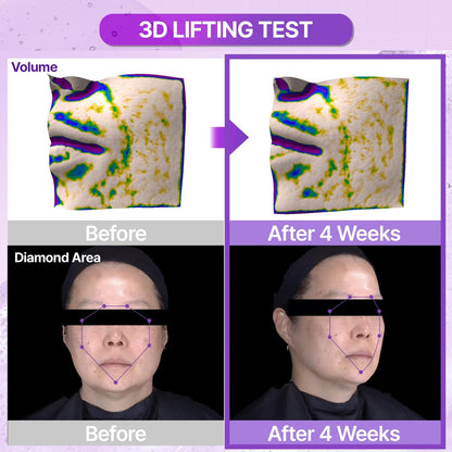 BIOHEAL BOH Probioderm™ 3D Lifting Ampulle 30 ml | Fortschrittliches Elastizitätsserum für gestraffte, feste Haut | Tägliche Hautpflege mit Probiotika & Peptiden