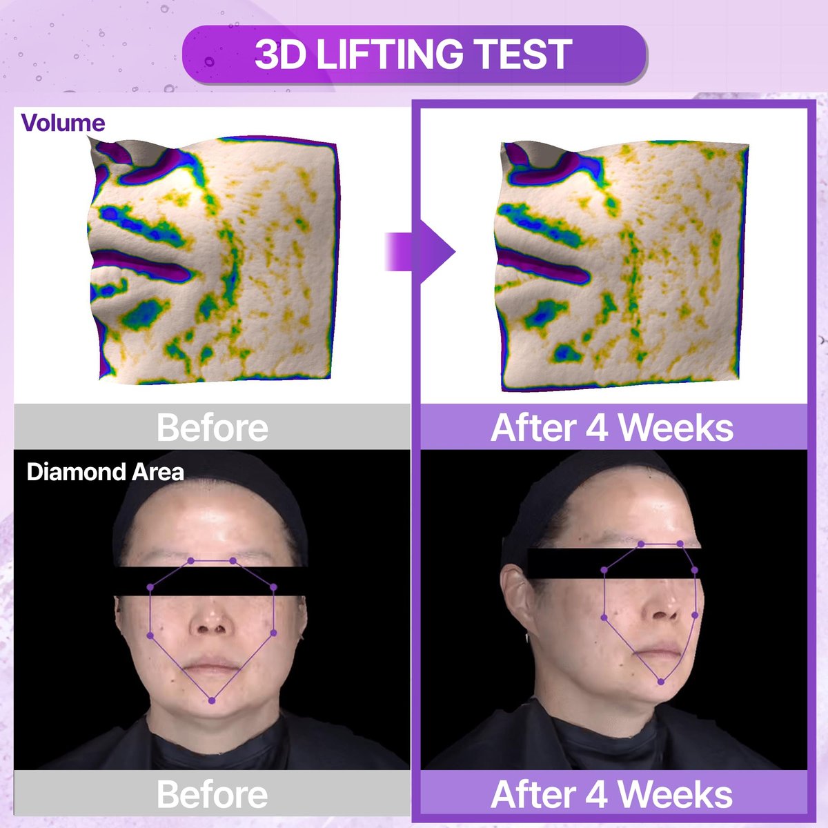 BIOHEAL BOH Probioderm™ 3D Lifting Ampulle 30 ml | Fortschrittliches Elastizitätsserum für gestraffte, feste Haut | Tägliche Hautpflege mit Probiotika & Peptiden