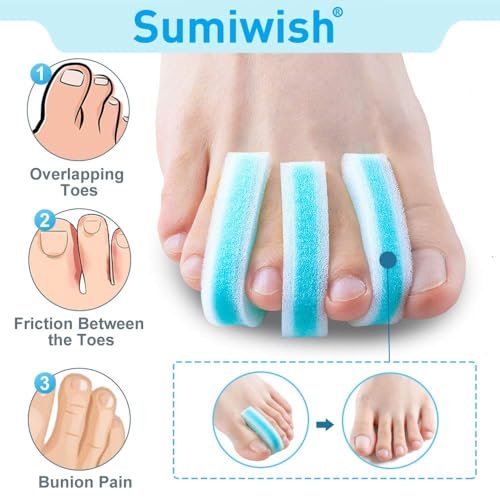 Sumiwish Schaumstoff Zehenspreizer, 20er-Pack Atmungsaktive Zehenabstandshalter, Reduzieren Reibung und Lindern Hühneraugen Schmerzen, Überlappende Zehenkorrektor - Blau