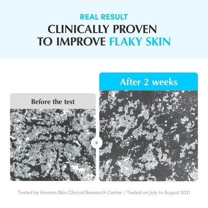 EQQUALBERRY Swimming Pool Toner – Korean Toner für sanftes Peeling & tiefe Feuchtigkeitsversorgung mit natürlichem Enzym-Protease & Hyaluronsäure, für empfindliche Haut, 155 ml