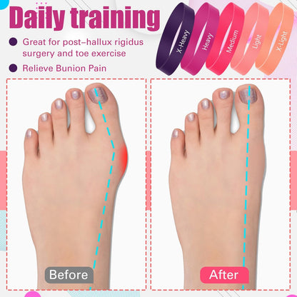 WinnerWhy Set von 5 Zehenspreizer Bänder Separator Spacer Ballenkorrektur Hallux Valgus Ausrichtung Fußstrecker Begradiger Widerstandsschleife Yoga Übung Fußpflege mit Aufbewahrungstasche (Pink)
