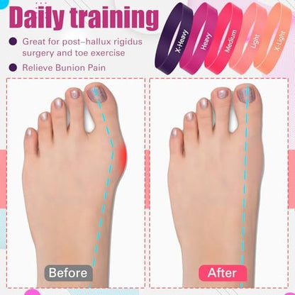 WinnerWhy Set von 5 Zehenspreizer Bänder Separator Spacer Ballenkorrektur Hallux Valgus Ausrichtung Fußstrecker Begradiger Widerstandsschleife Yoga Übung Fußpflege mit Aufbewahrungstasche (Pink)