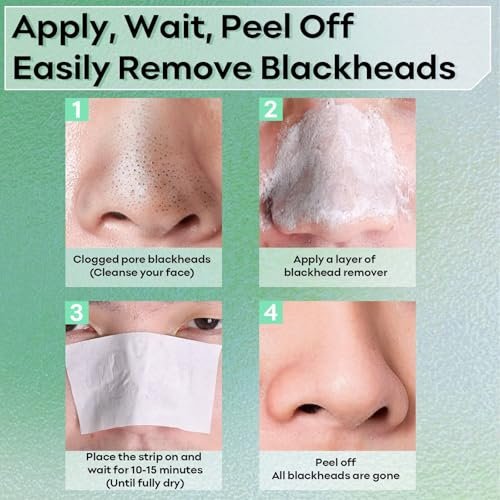 SYABO Blackhead Remover – 100 Nasenporenstreifen & 50g Peeling-Maske für reine Haut