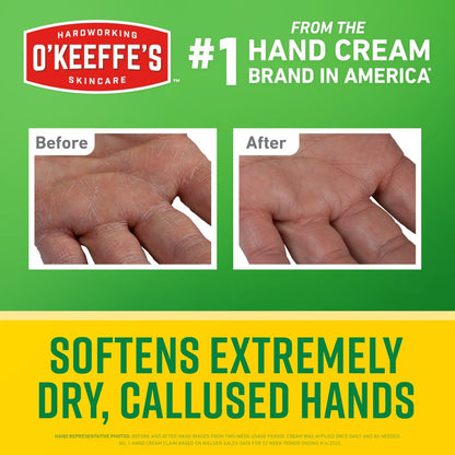 O'Keeffe's Working Hands Intense Renewal Handcreme mit Harnstoff, 2er-Pack (2 x 85 g) – Pflegt und glättet extrem trockene, verhornte Hände