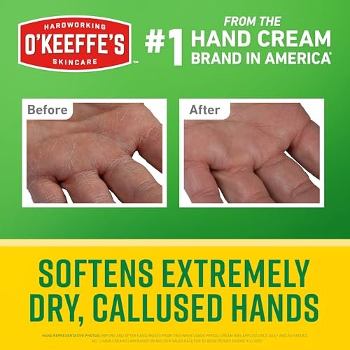 O'Keeffe's Working Hands Intense Renewal Handcreme mit Harnstoff, 2er-Pack (2 x 85 g) – Pflegt und glättet extrem trockene, verhornte Hände