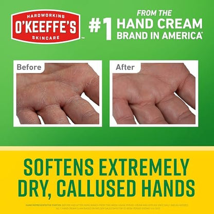 O'Keeffe's Working Hands Intense Renewal Handcreme mit Harnstoff, 2er-Pack (2 x 85 g) – Pflegt und glättet extrem trockene, verhornte Hände