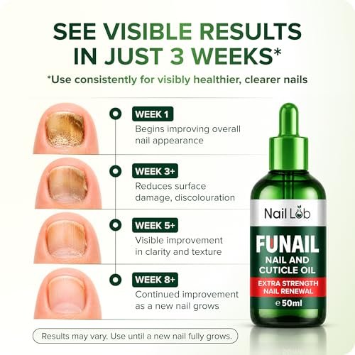 NAIL LAB Premium Nagelbehandlung für Zehennägel Extra Stark - 50ml - mit Teebaumöl, Nagelpflege für Fingernägel - inkl. kostenlosem 3ml Nagelpflegestift + Nagelfeile