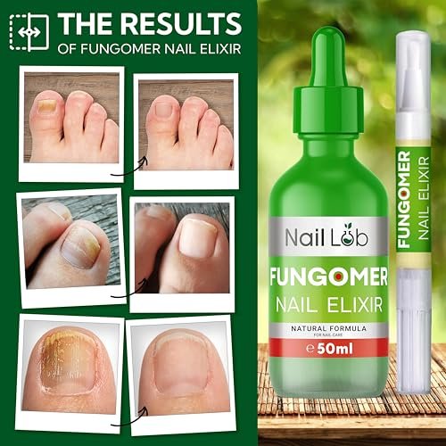 NAIL LAB Premium Nagelbehandlung für Zehennägel Extra Stark - 50ml - mit Teebaumöl, Nagelpflege für Fingernägel - inkl. kostenlosem 3ml Nagelpflegestift + Nagelfeile