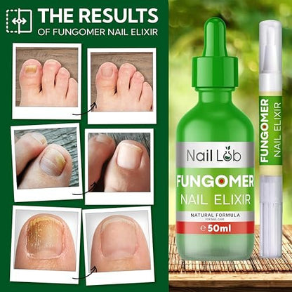 NAIL LAB Premium Nagelbehandlung für Zehennägel Extra Stark - 50ml - mit Teebaumöl, Nagelpflege für Fingernägel - inkl. kostenlosem 3ml Nagelpflegestift + Nagelfeile