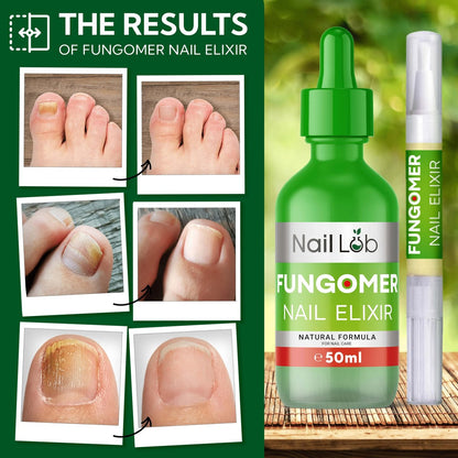 NAIL LAB Premium Nagelbehandlung für Zehennägel Extra Stark - 50ml - mit Teebaumöl, Nagelpflege für Fingernägel - inkl. kostenlosem 3ml Nagelpflegestift + Nagelfeile