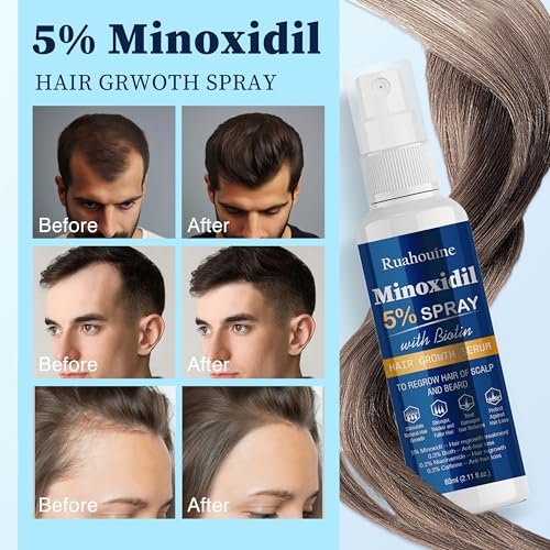 5% Minoxidil Haarwuchsspray mit Bürste für Frauen & Männer, Minoxidil Biotin für Männerbart, 60 ml / 2,11 fl.oz