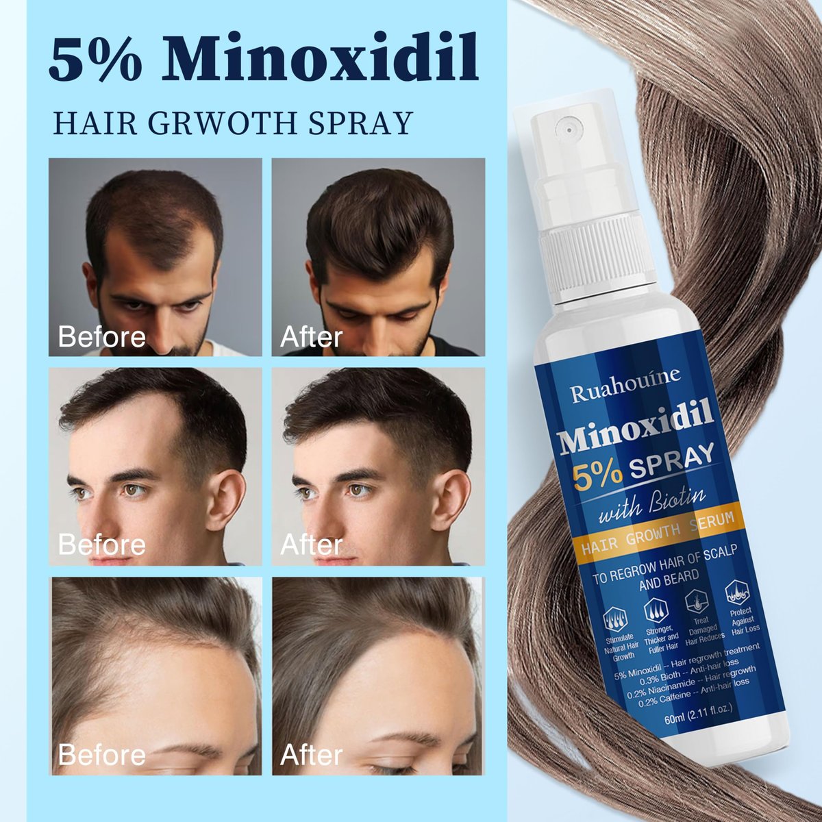 5% Minoxidil Haarwuchsspray mit Bürste für Frauen & Männer, Minoxidil Biotin für Männerbart, 60 ml / 2,11 fl.oz