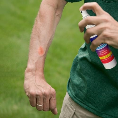 BurnFix® Hydrogel Brandspray – 120 ml Sofortige Kühlung bei Verbrennungen 1. & 2. Grades, Sonnenbrand & Verbrühungen | Arztempfohlene feuchtigkeitsspendende Erste-Hilfe für Kinder & Erwachsene