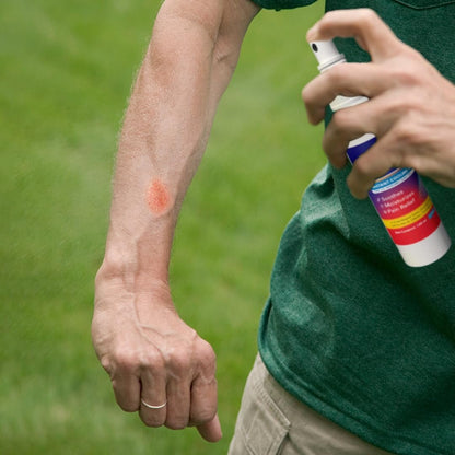 BurnFix® Hydrogel Brandspray – 120 ml Sofortige Kühlung bei Verbrennungen 1. & 2. Grades, Sonnenbrand & Verbrühungen | Arztempfohlene feuchtigkeitsspendende Erste-Hilfe für Kinder & Erwachsene