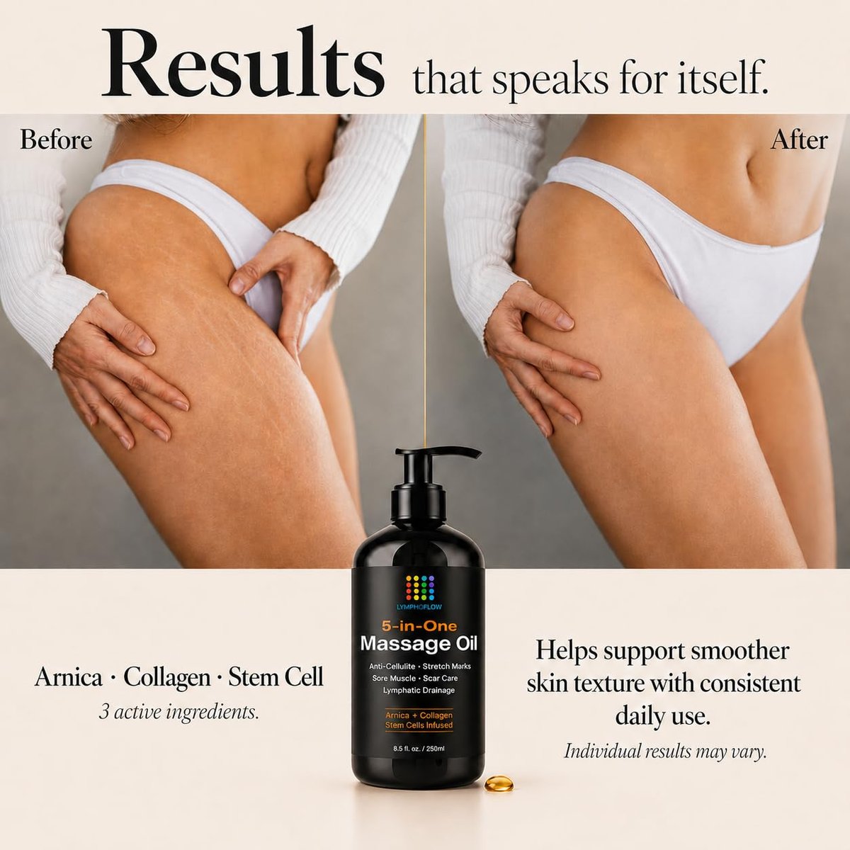5-in-1 Lymphdrainage-Massageöl für Massagetherapie - Glättet das Erscheinungsbild von Cellulite & verbessert die Hauttextur - Nach OP-Erholung & Lipo, BBL, Tummy Tuck, Fibrose-Behandlung - 8,5 Unzen